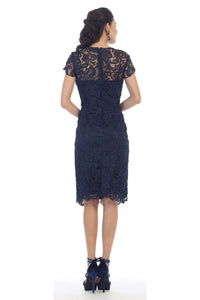 Short sleeve lace short dress- MQ1106